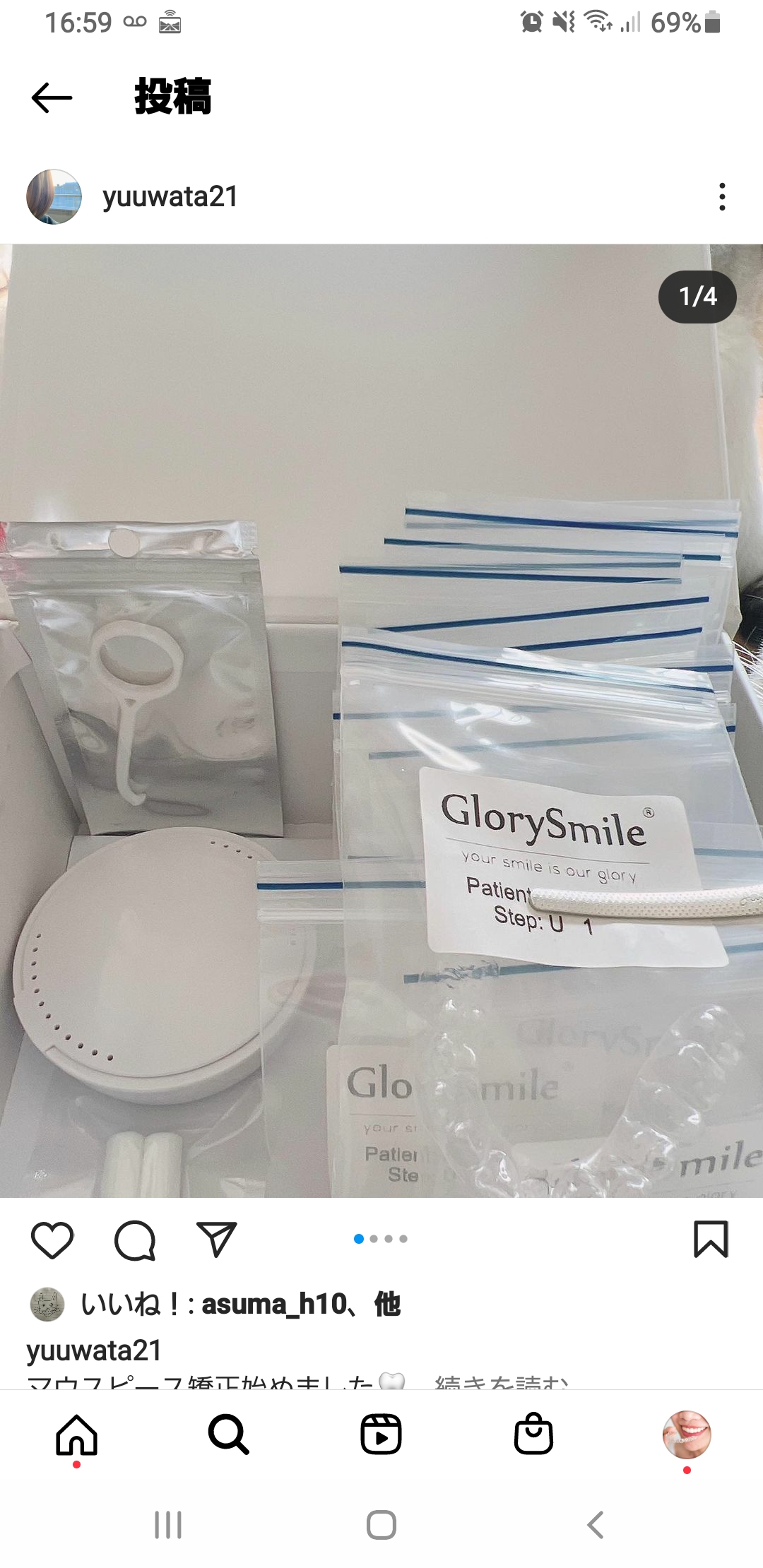 マウスピース矯正始めました