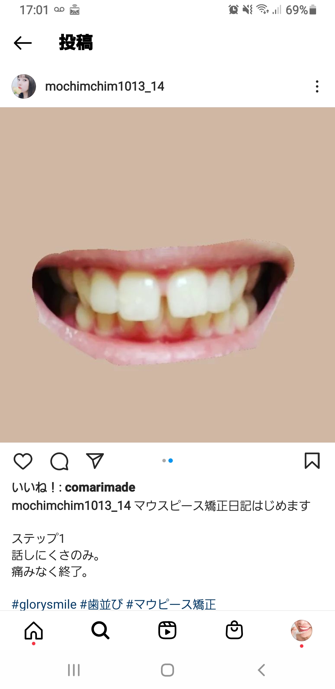 マウスピース矯正日記始めます。