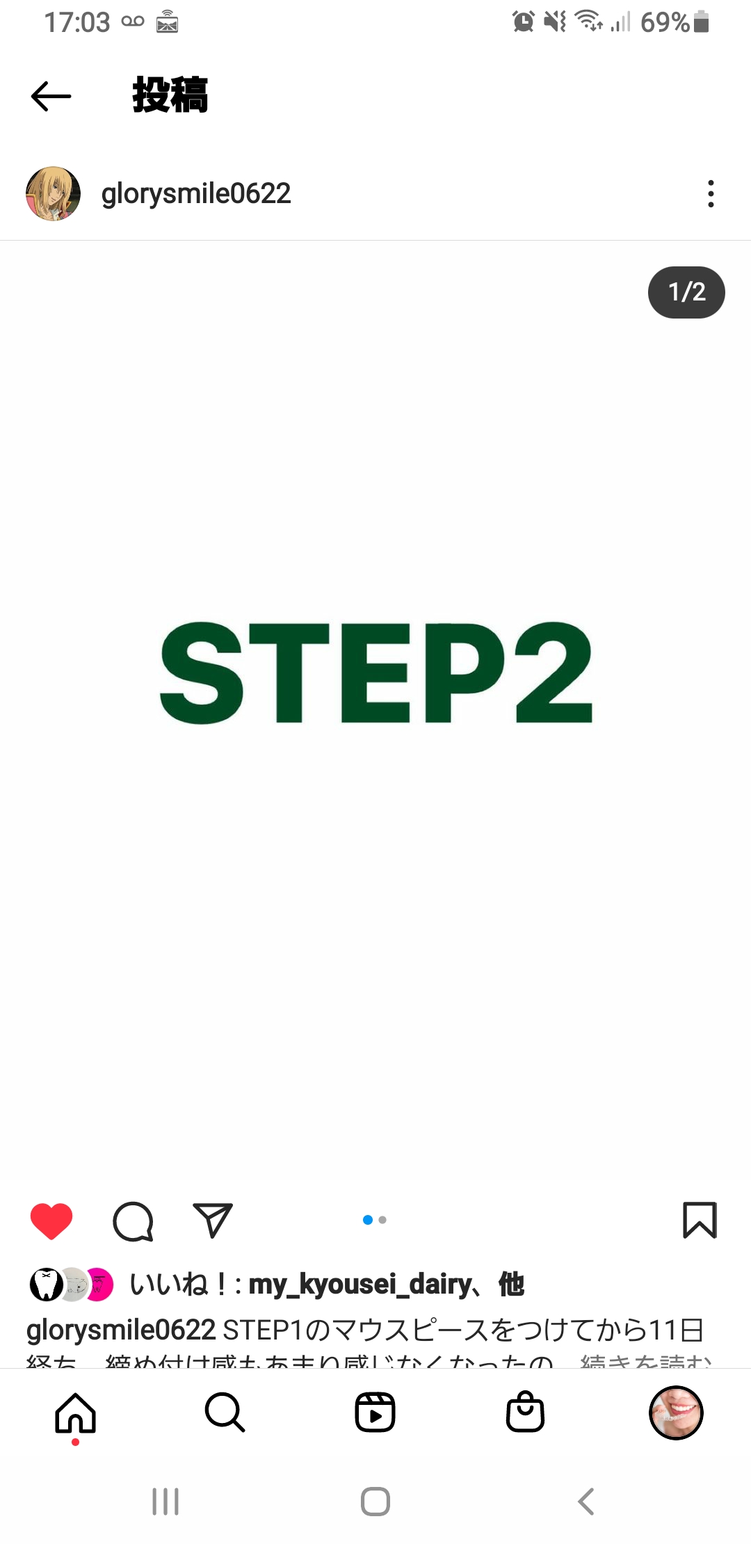 STEP1のマウスピースをつけてから11日経ち